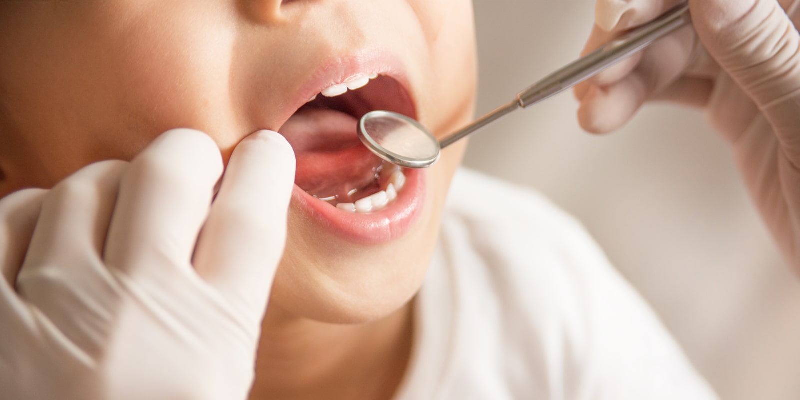 当院の小児歯科について