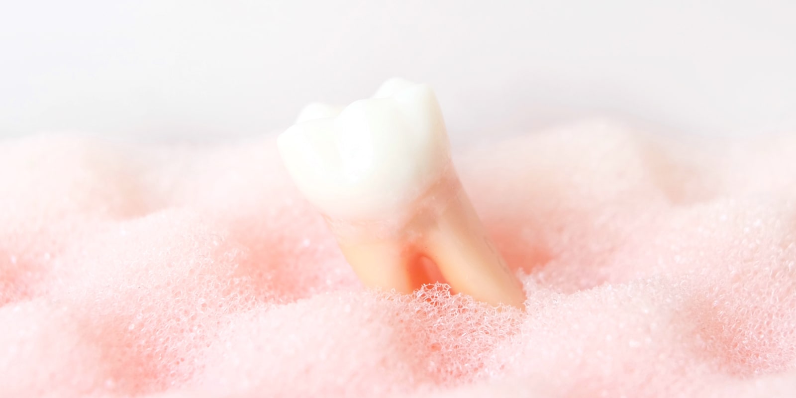 当院の歯周病（歯槽膿漏）の治療について